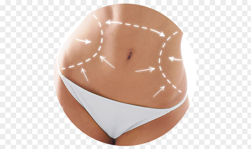 Milano Liposuction Plastic Surgery Human Body Medicine PNG