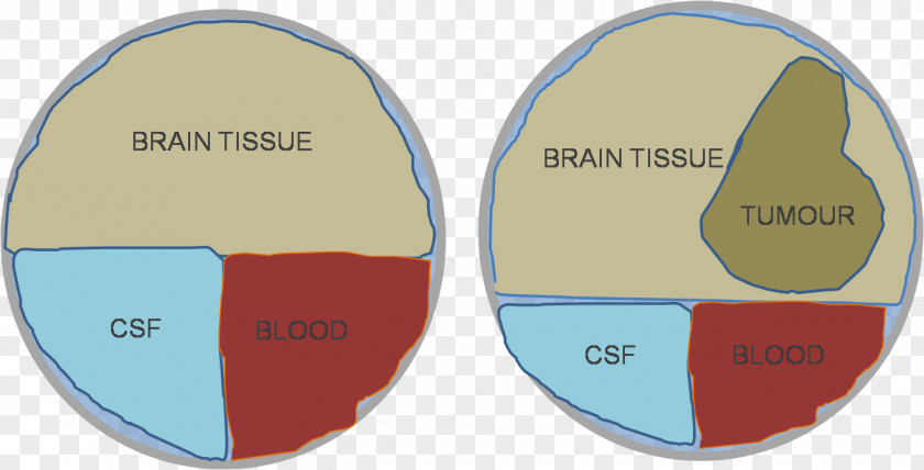 Brain Doktryna Monro-Kelliego Cerebrospinal Fluid Blood Hypothesis PNG