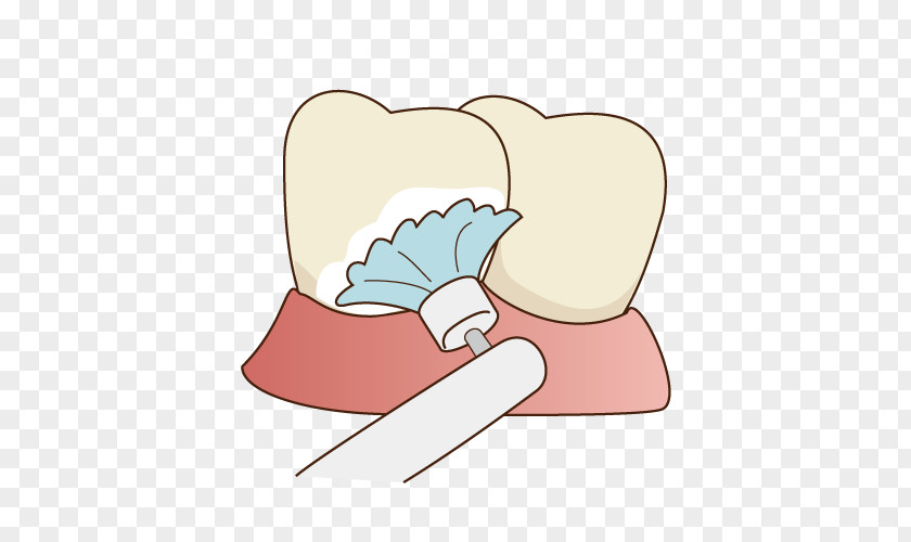 Dental Tooth Decay Teeth Cleaning Periodontal Disease Dentist PNG