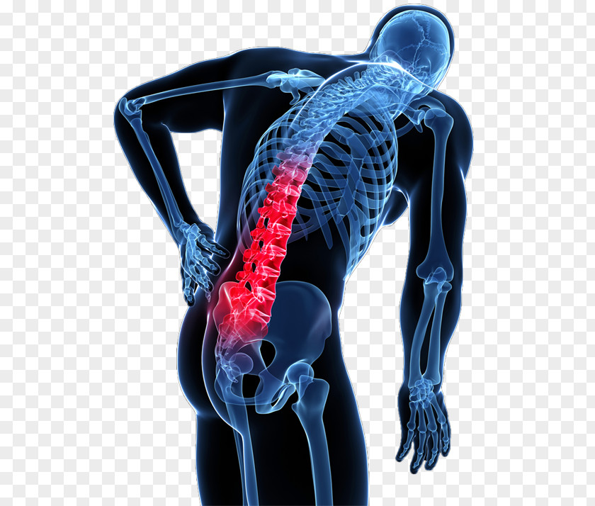 Back Pain Low Human Vertebral Column PNG