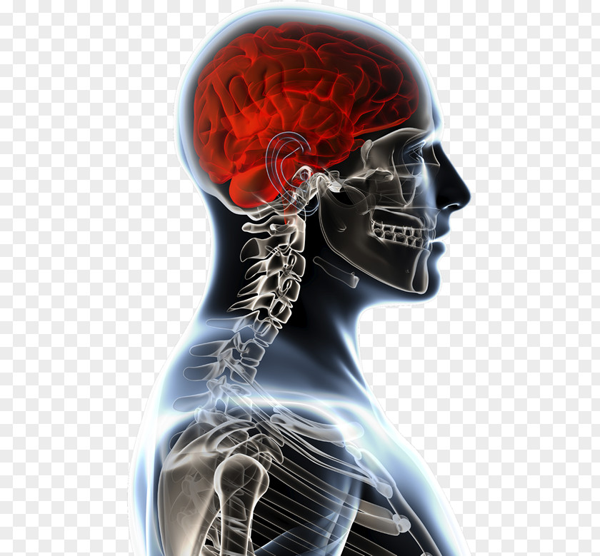 Head Injury Brain Tumor Anatomy Anatomia Y Fisiologia Physiology PNG