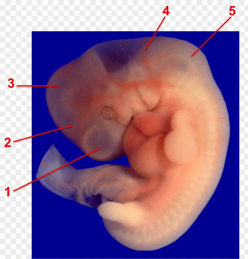 Brain Vesículas Encefálicas Primarias Embryo Embriologia Humana Developmental Biology PNG