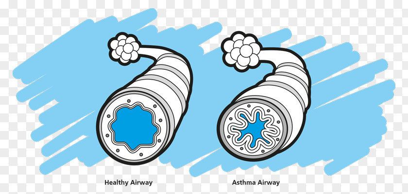 Asthma Spacer Nursing Care Plan Disease Clip Art PNG