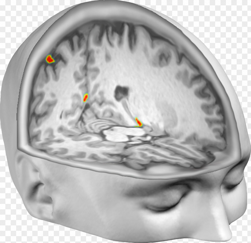 Brain Out-of-body Experience Neuroscience Neuroimaging PNG