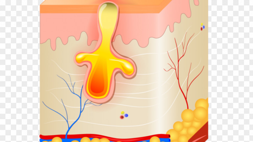 Rendez Vous Sebaceous Gland Poil Inflammation Acne Comedo PNG