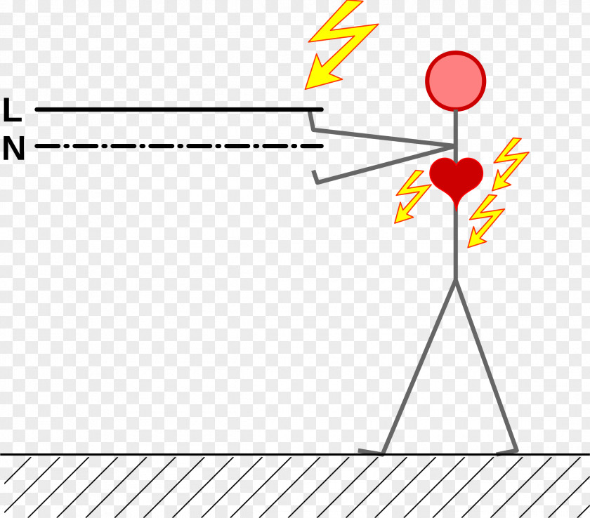 Accident Electrical Injury Electric Current Diagram Clip Art PNG