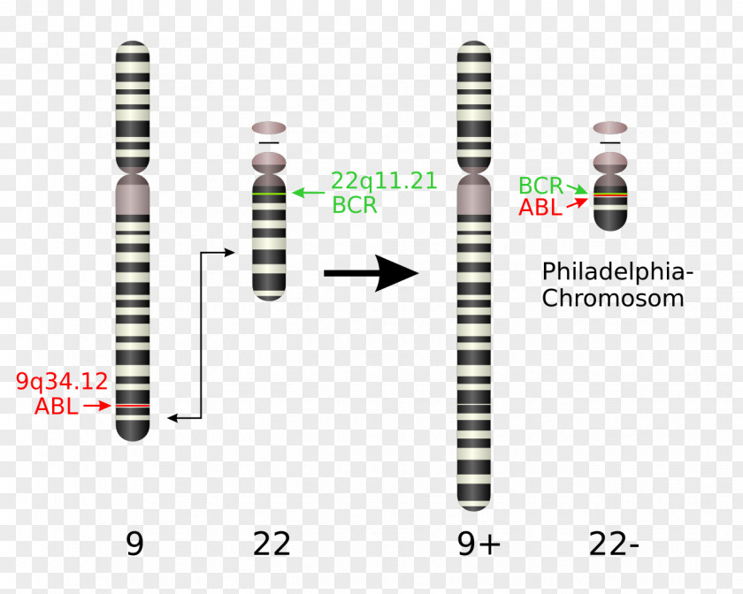 Chromosome Philadelphia Chromosomal Translocation Chronic Myelogenous Leukemia Abnormality PNG