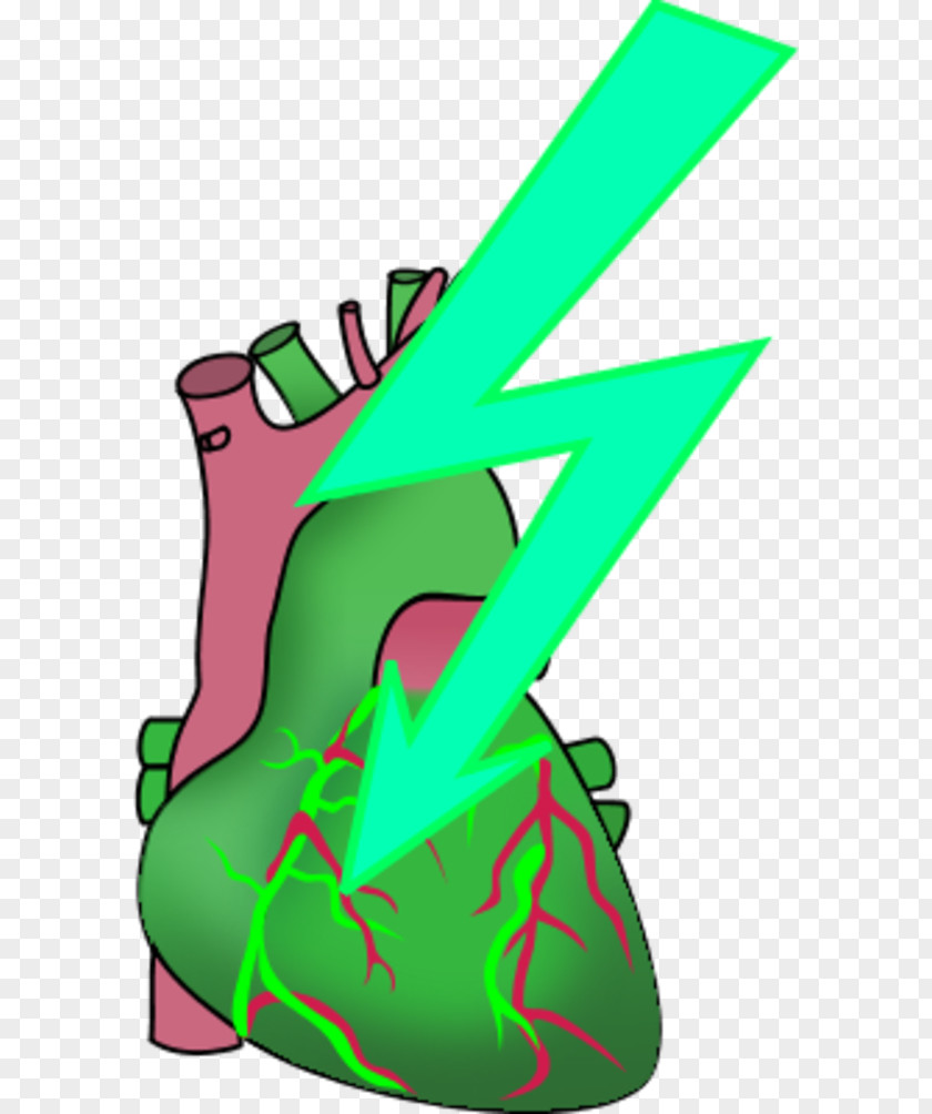 Heart Attack Anatomy Human Body Clip Art PNG