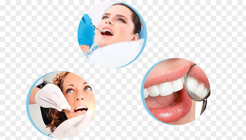 Dentistry Tooth Whitening Dental Implant Endodontic Therapy PNG