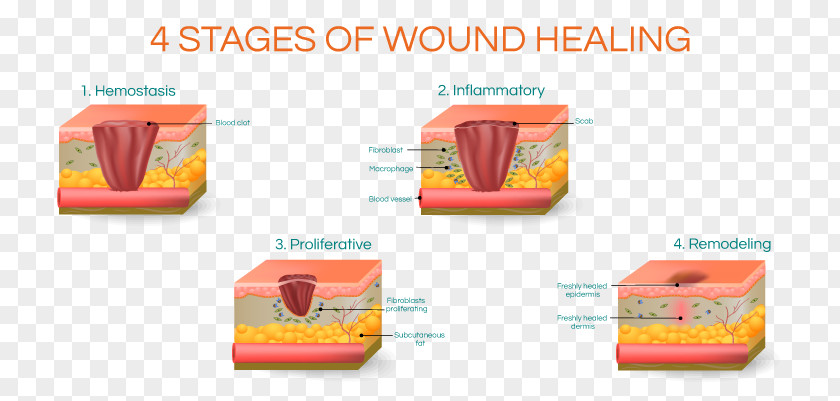 Scar Wound Healing Surgery PNG
