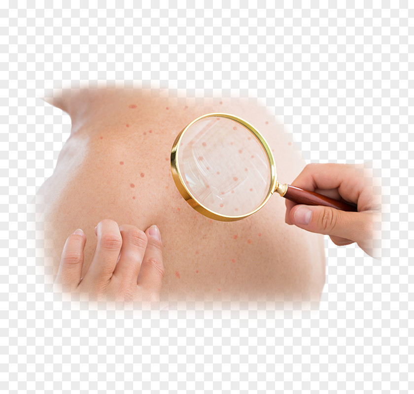 Skin Problems Dermatology Cancer Medicine Disease PNG