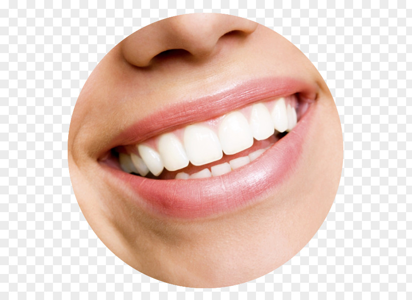 Dental Smile Tooth Whitening Cosmetic Dentistry Human PNG