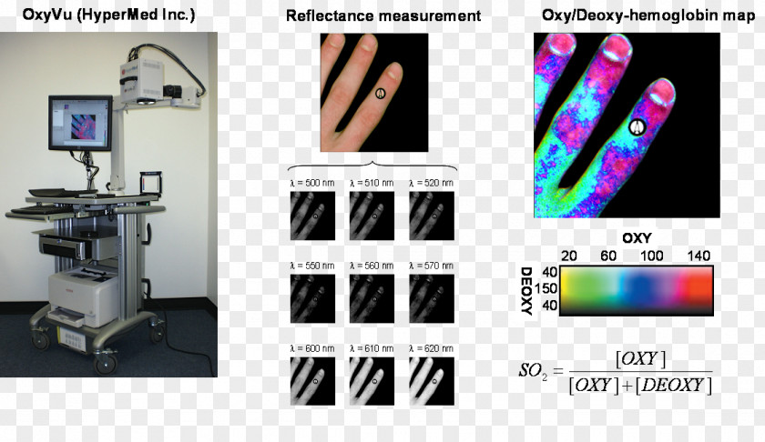 Biomedical Journal Of Optics Hyperspectral Imaging Engineering Diabetic Foot PNG