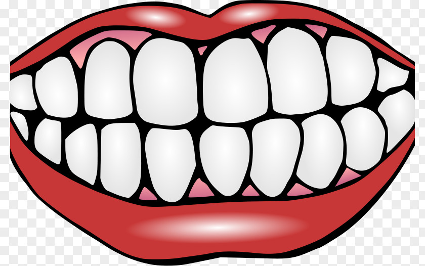 Human Tooth Decay Clip Art PNG