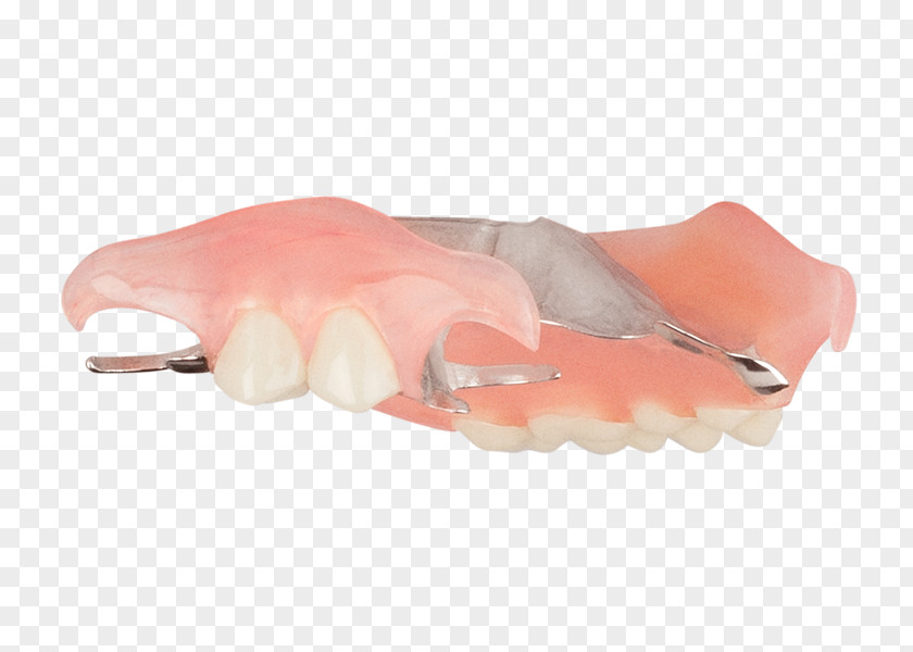 Top Angle Dentures Removable Partial Denture Tooth Dentistry Home Improvement PNG