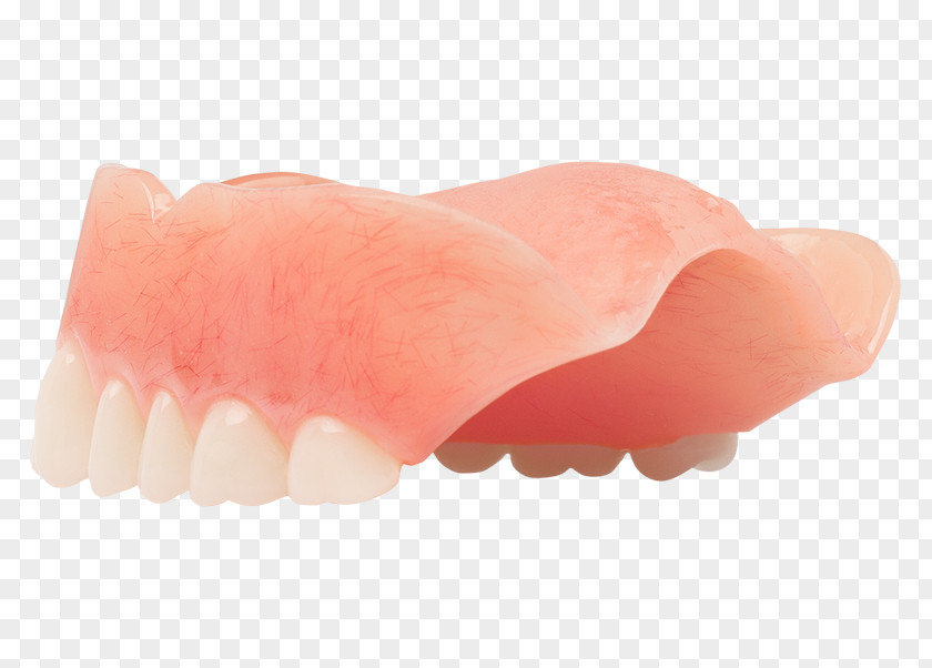 Dentures Human Tooth Dentistry Aspen Dental PNG