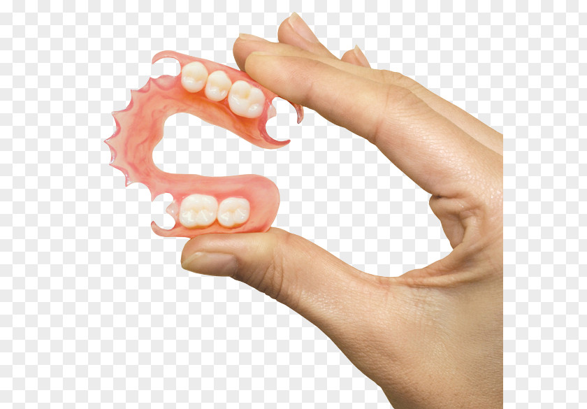 Bridge Removable Partial Denture Dentures Dentistry Prosthodontics PNG