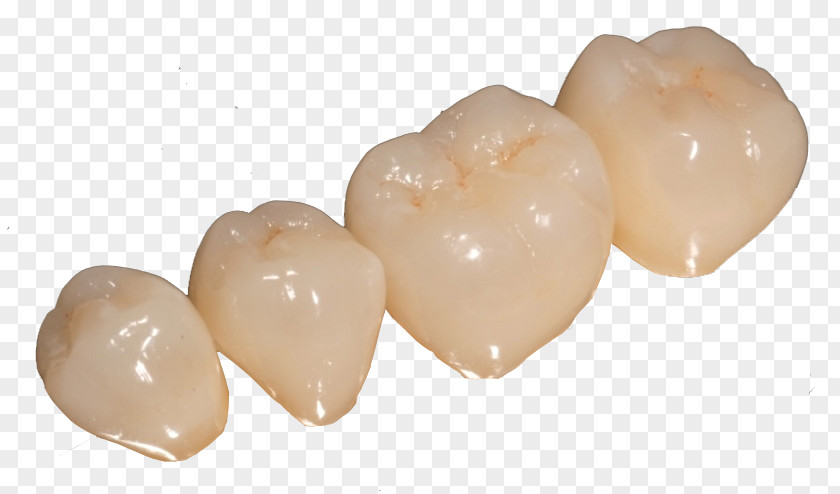 Steel Teeth Dentures Prótesis Fija Tooth Crown Dentist PNG