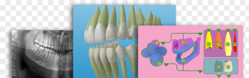 3d Dental Treatment For Toothache Anatomy Tooth Graphic Design Dentistry PNG