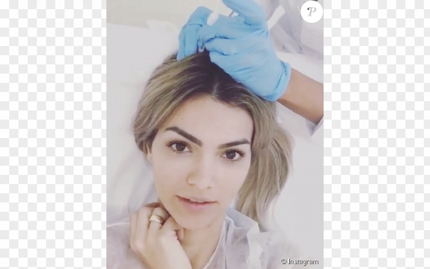 Kelly Key Injection Mesotherapy Head Hair PNG