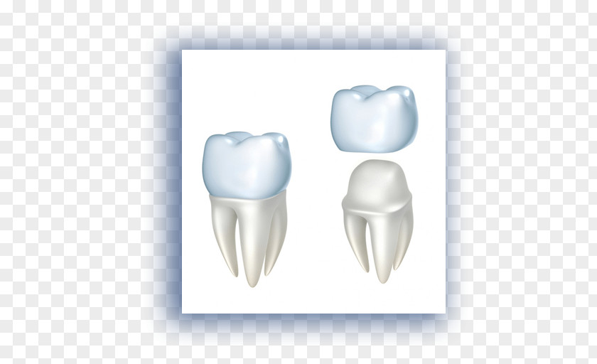 Damaged Tooth Crown Dentistry Dental Restoration Implant PNG