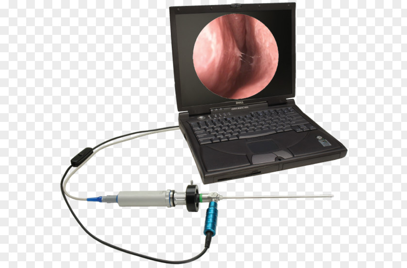 Digicam Capsule Endoscopy Otorhinolaryngology Video Cameras Physician PNG