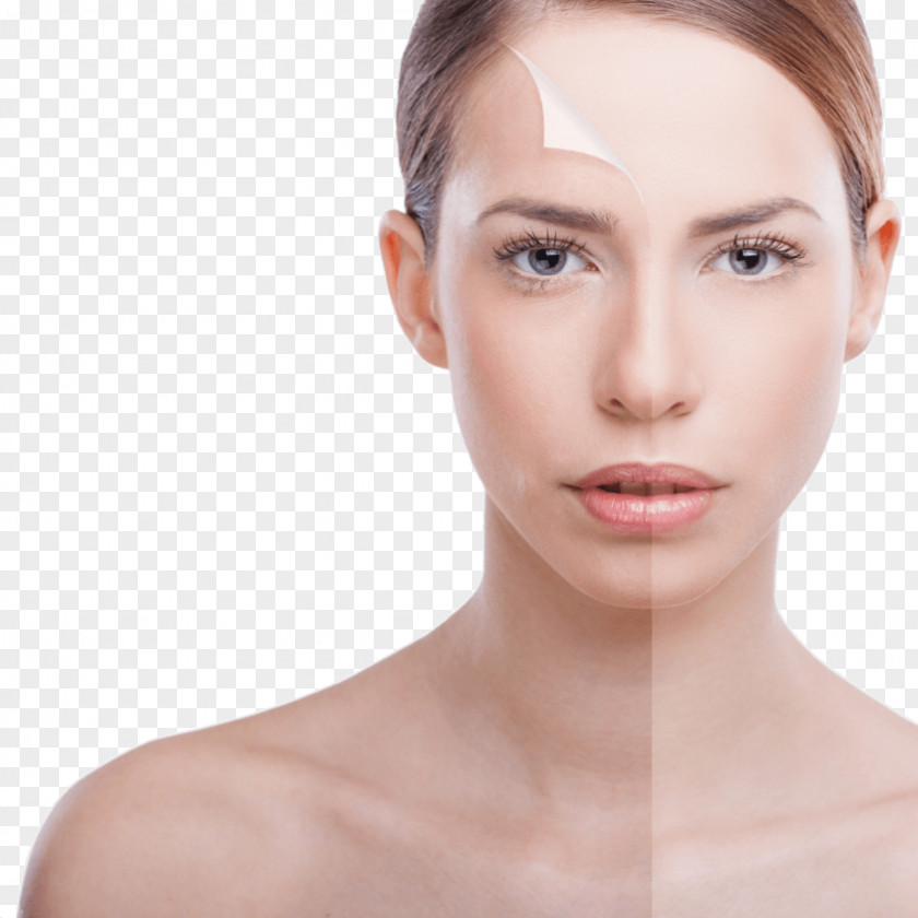 Plump Chemical Peel Exfoliation Facial Photorejuvenation Beauty Parlour PNG