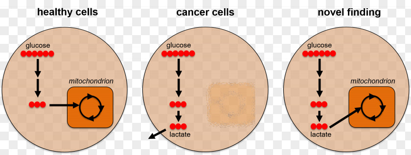 Cute Cancer Cell Details Metabolism Metabolomics PNG