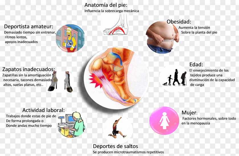 Foot Print Plantar Fasciitis Sole Ache Nerve PNG