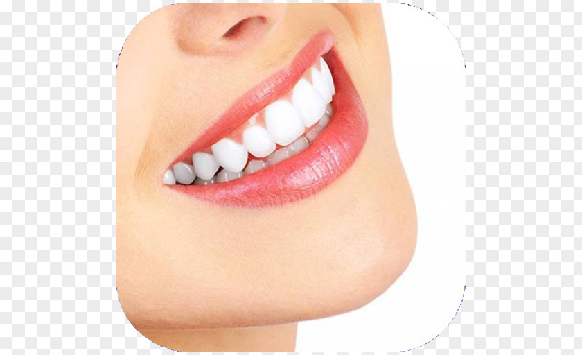 Cosmetic Dentistry Dental Implant Oral Hygiene PNG dentistry implant hygiene, others clipart PNG