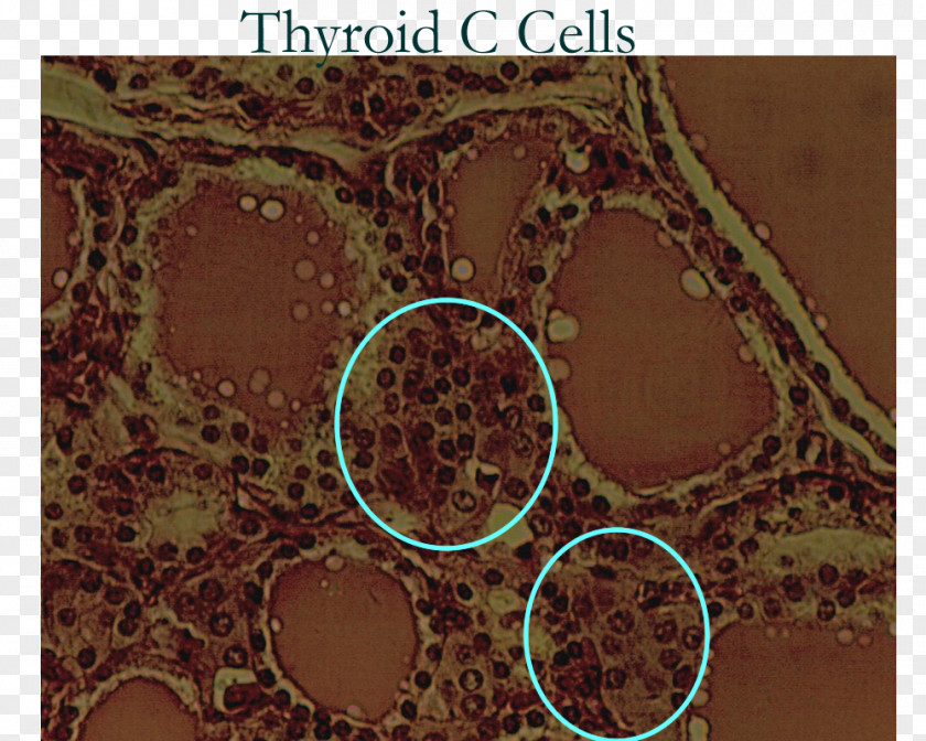 Endocrine Parafollicular Cell Thyroid System PNG