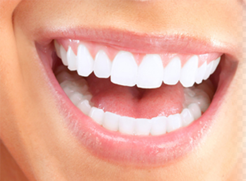 Tooth Health Cosmetic Dentistry Smile PNG