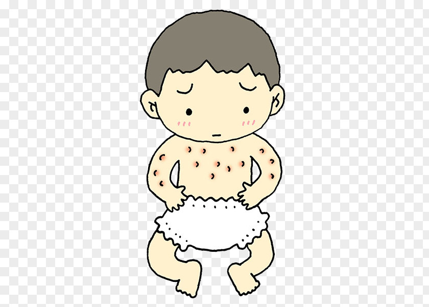 Infant Skin Allergy Atopic Dermatitis No PNG