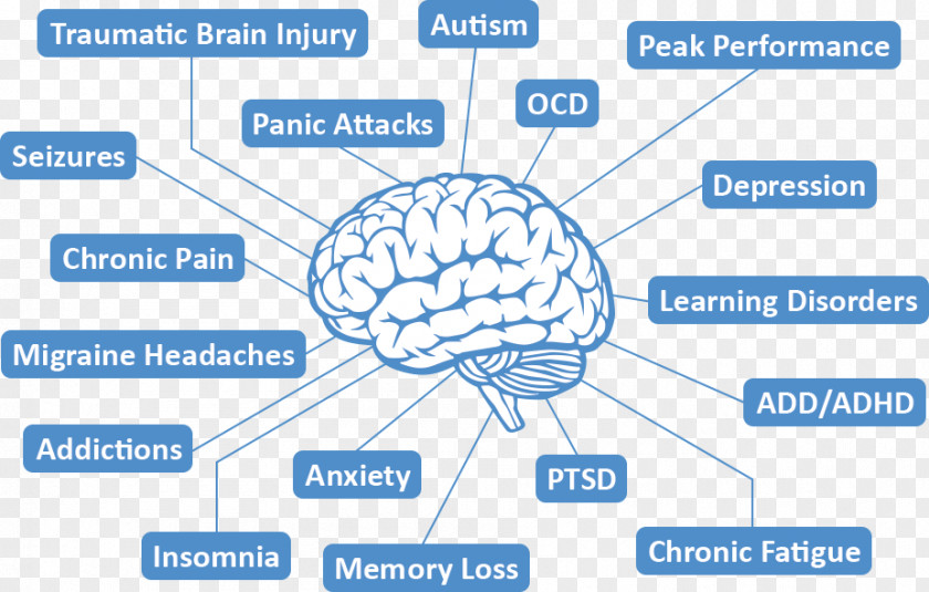 Brain Mapping Neurofeedback Therapy Quantitative Electroencephalography PNG