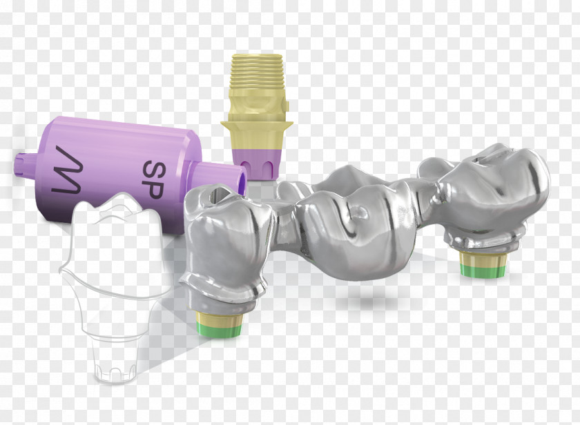 Overdenture Abutment Dental Implant Computer-aided Design Bilgisayarlı Tasarım/Bilgisayarlı üretim CAD/CAM Dentistry PNG