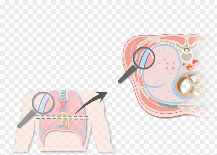 Pulmonary Pleurae Pleural Cavity Thoracic Effusion Lung PNG