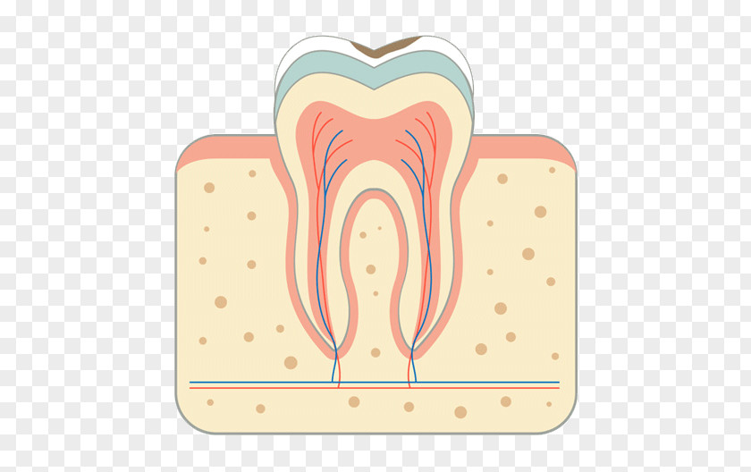 Bridge Tooth Decay Periodontal Disease Root Canal PNG
