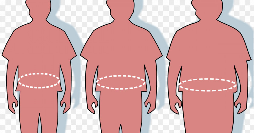 Health Abdominal Obesity Adipose Tissue Waist Fatty Liver PNG