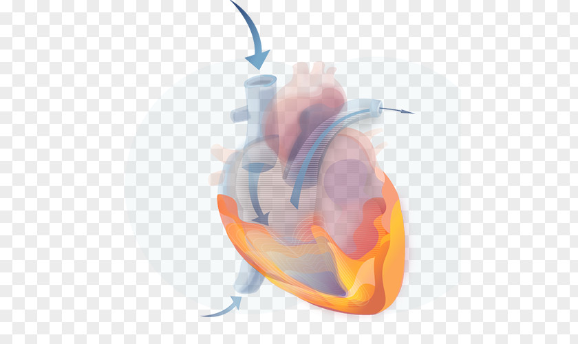 Cardiovascular Disease Diabetes Mellitus Heart Myocardial Infarction PNG
