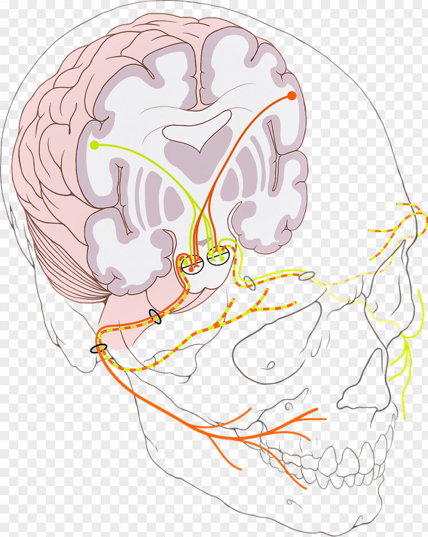Facial Nerve Paralysis Cranial Nerves Bell's Palsy PNG