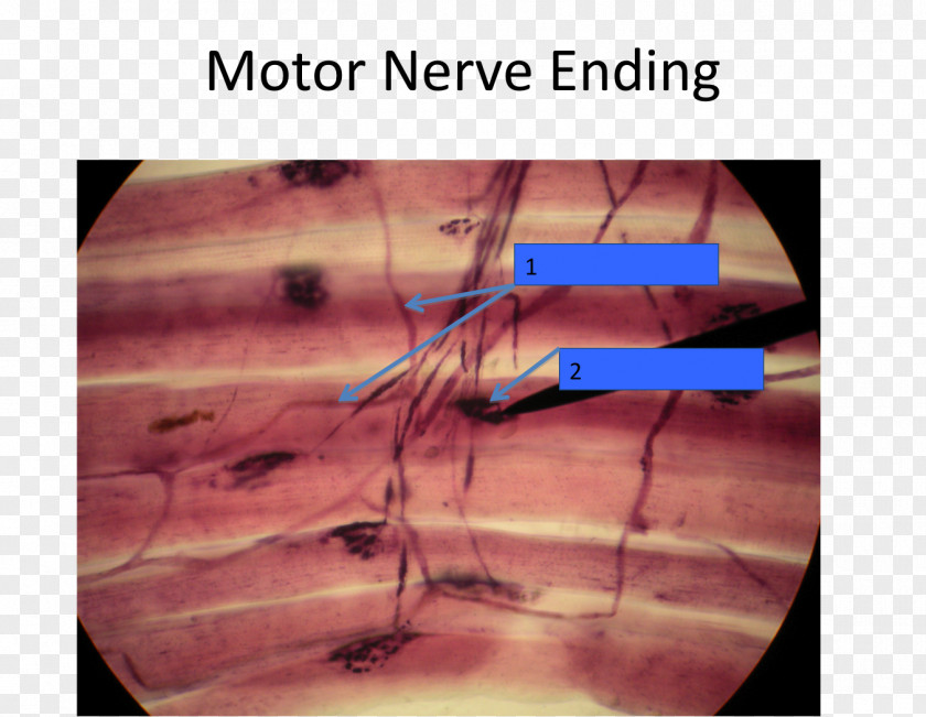 Dendrite Motor Nerve Free Ending Nervous System Tissue Axon Terminal PNG