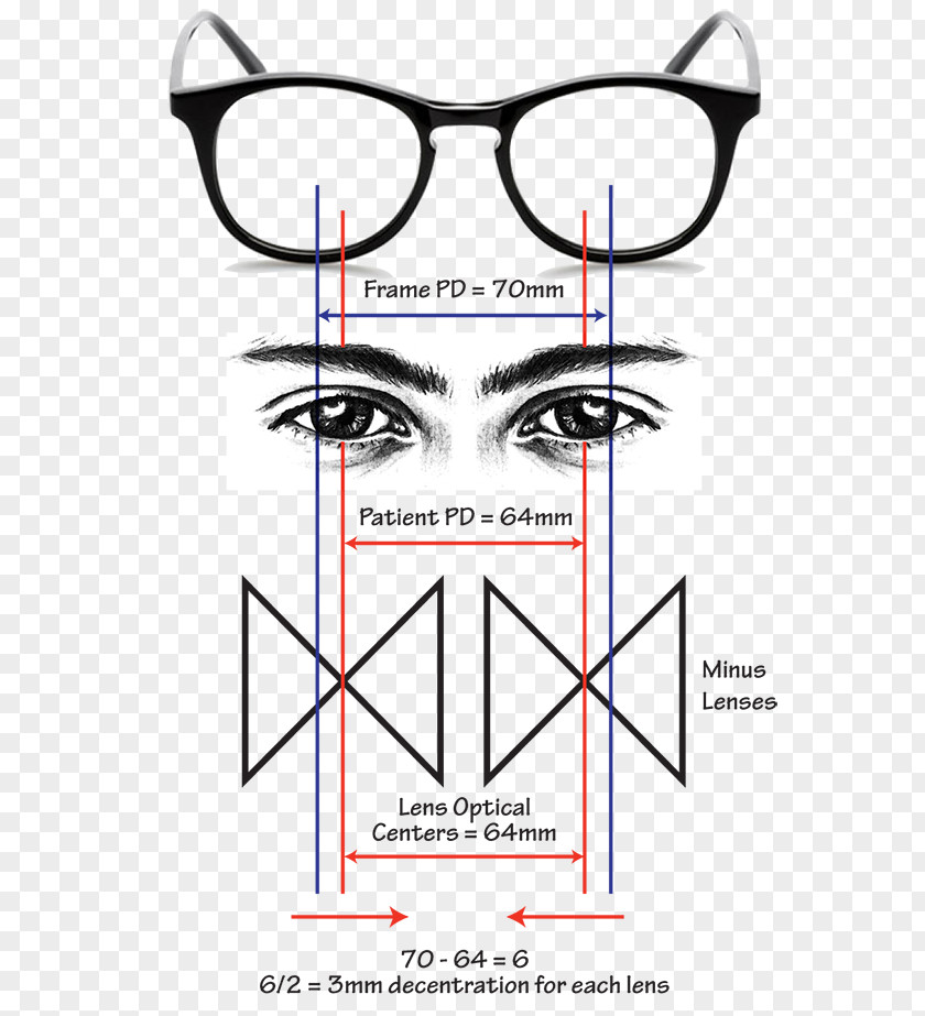 Glasses L'Optique Optometry Lens Astigmatism PNG