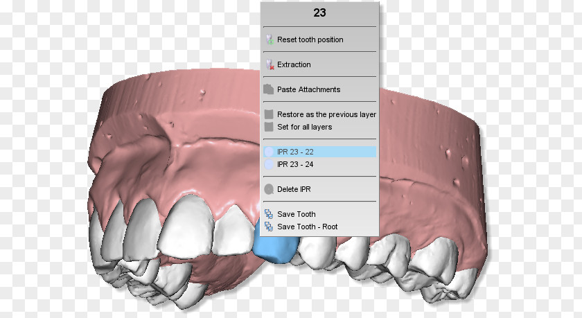 Dental Teeth Model Tooth Clipboard Product Manuals Dentistry Computer Software PNG