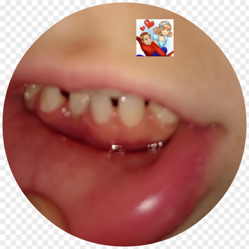 Baby Teeth Chin Cheek Mouth Jaw Lip PNG