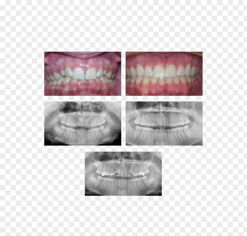 Chris Pugeda Dmd Palatine Mount Prospect Arlington Orthodontics Dental Braces PNG