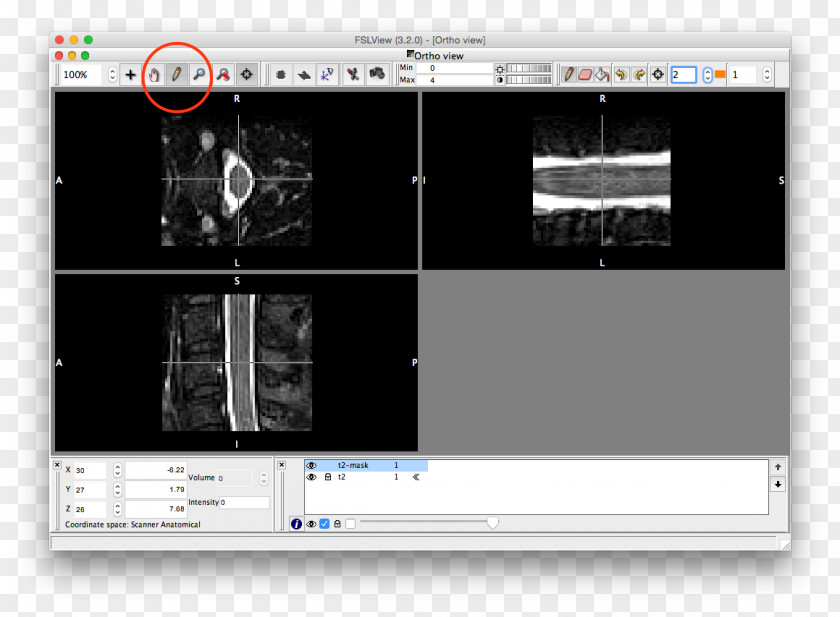 Spinal Cord Envelope Amplitude FMRIB Software Library Angle Talairach Coordinates PNG