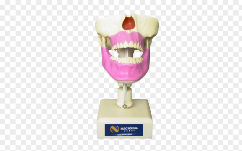 Maxilla Dentistry Alaleuanluu Jaw Surgery PNG