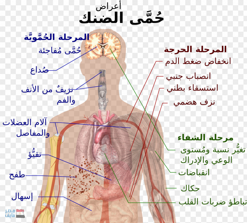 Mosquito Dengue Fever Mosquito-borne Disease Virus PNG