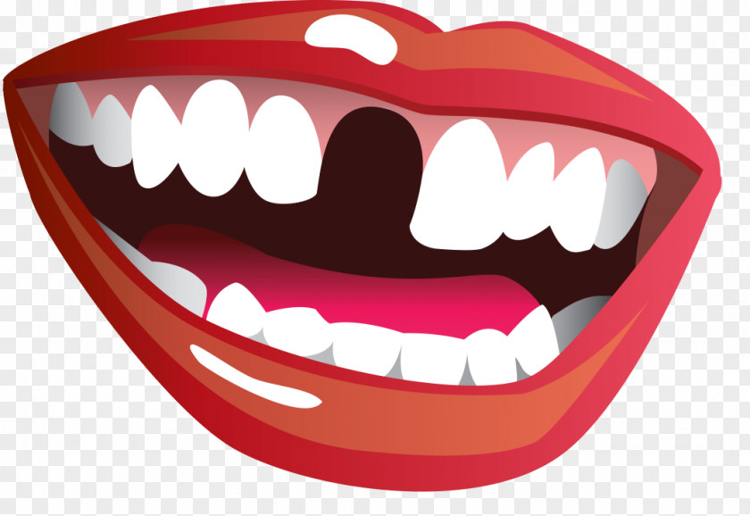 Missing Tooth Cliparts Dentistry Clip Art PNG