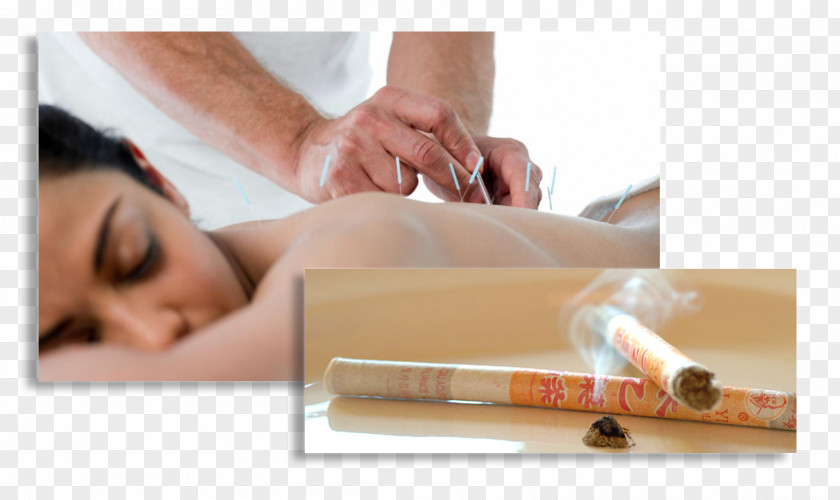 Acupuntura Massage Alternative Health Services Acupuncture North Dakota PNG